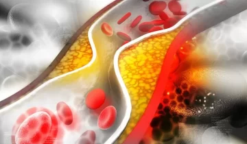 Cholesterolis-1